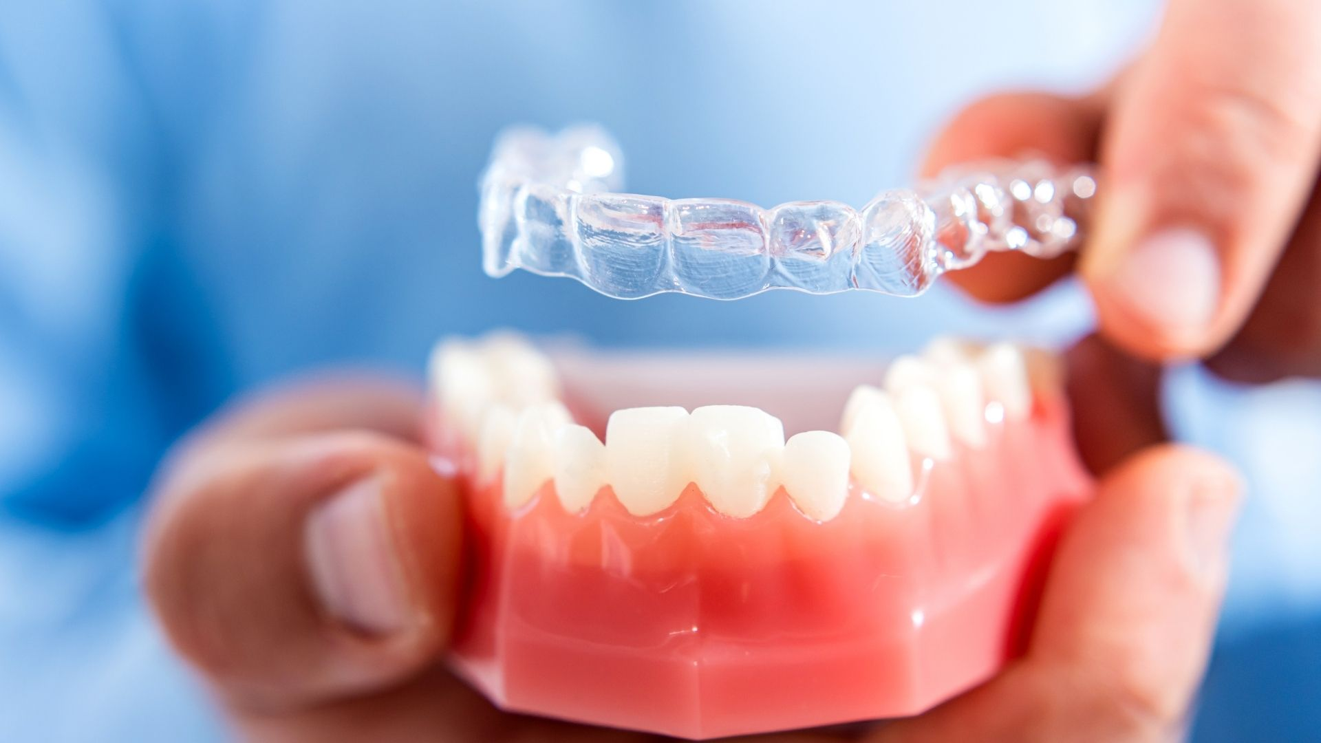 Clear Aligner Therapy