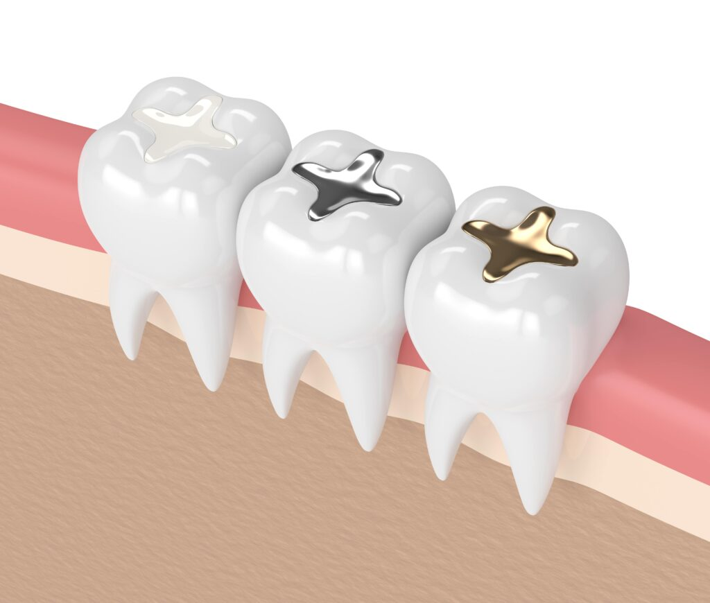 Fillings